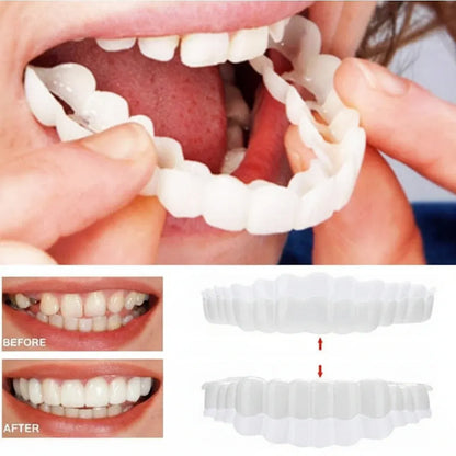 Budget-Friendly Removable Smile Veneers with Natural Look