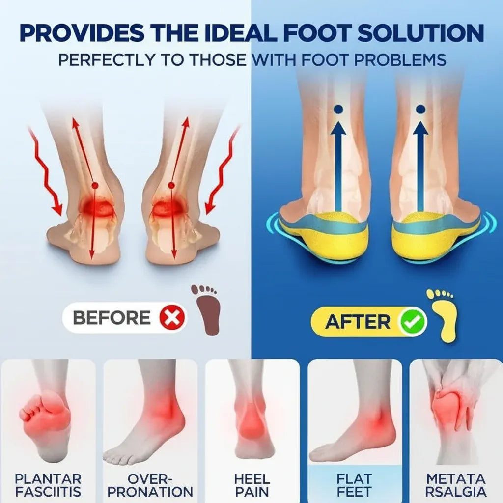 Magnetic Acupressure Arch Support Insoles for Running