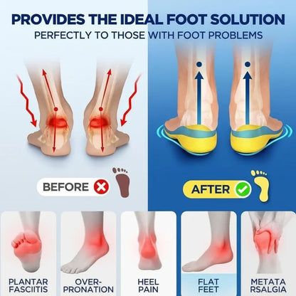 Magnetic Acupressure Arch Support Insoles for Running